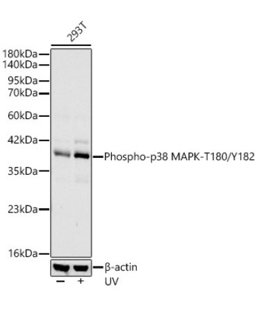 Phospho-p38 MAPK-T180/Y182 Rabbit Monoclonal Antibody