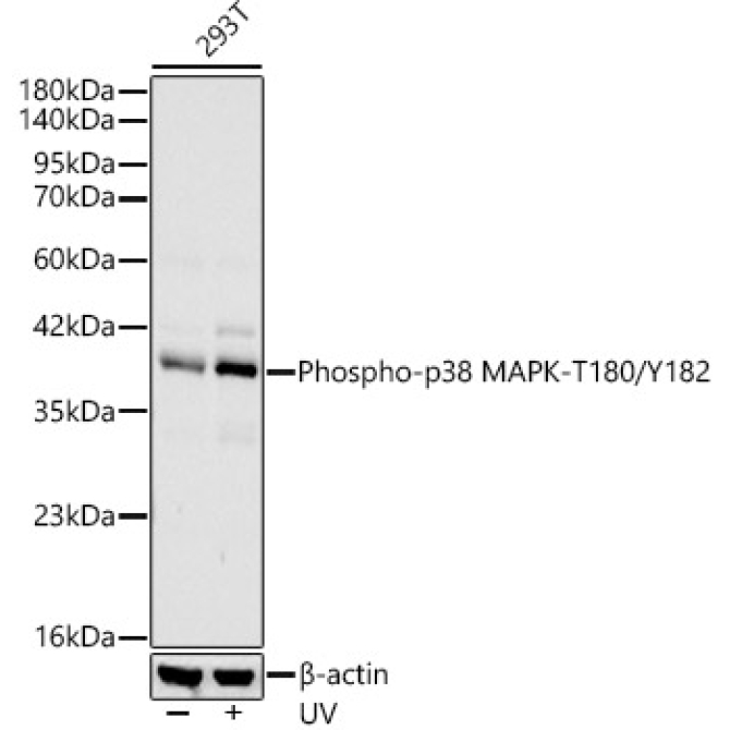 Phospho-p38 MAPK-T180/Y182 Rabbit Monoclonal Antibody