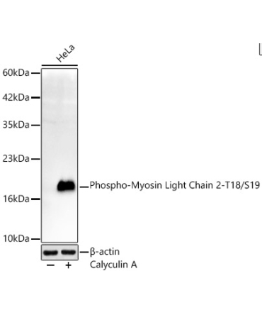 Phospho-Myosin Light Chain 2-T18/S19 Rabbit Monoclonal Antibody