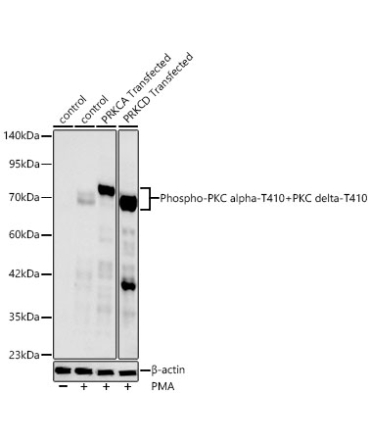 Phospho-PKC alpha-T410+PKC delta-T410 Rabbit Monoclonal Antibody
