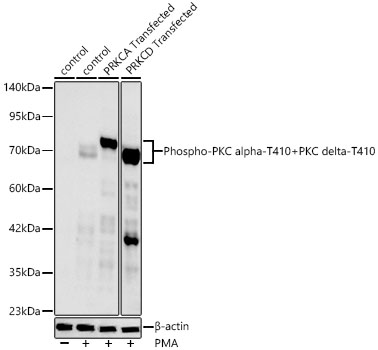 Phospho-PKC alpha-T410+PKC delta-T410 Rabbit Monoclonal Antibody