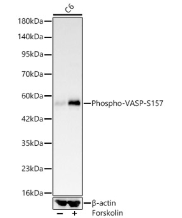 Phospho-VASP-S157 Rabbit Monoclonal Antibody