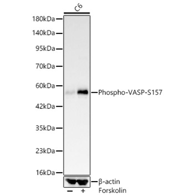 Phospho-VASP-S157 Rabbit Monoclonal Antibody