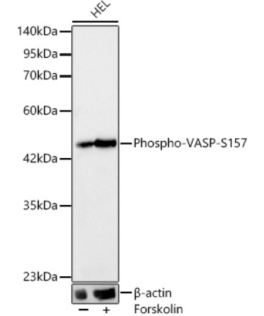 Phospho-VASP-S157 Rabbit Monoclonal Antibody