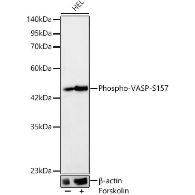 Phospho-VASP-S157 Rabbit Monoclonal Antibody