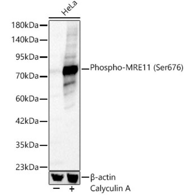 Phospho-MRE11 (Ser676) Rabbit Polyclonal Antibody