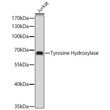 Tyrosine Hydroxylase Rabbit Polyclonal Antibody