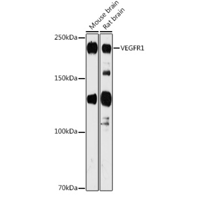 VEGFR1 Rabbit Polyclonal Antibody