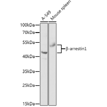 Beta-arrestin1 Rabbit Polyclonal Antibody