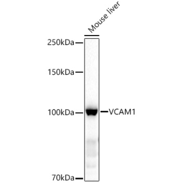 VCAM1 Rabbit Polyclonal Antibody