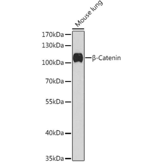 Beta-Catenin Rabbit Polyclonal Antibody