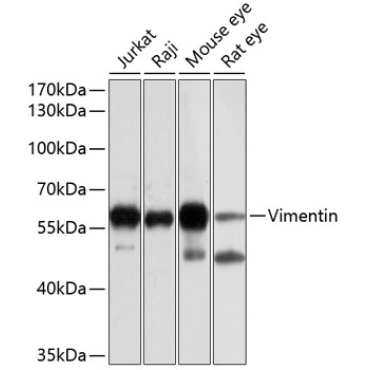 Vimentin Rabbit Polyclonal Antibody