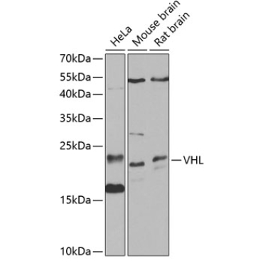 VHL Rabbit Polyclonal Antibody