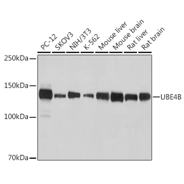 UBE4B Rabbit Monoclonal Antibody