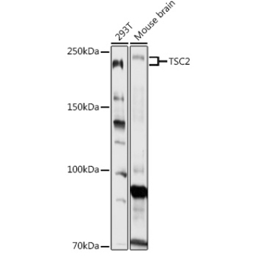 TSC2 Rabbit Polyclonal Antibody