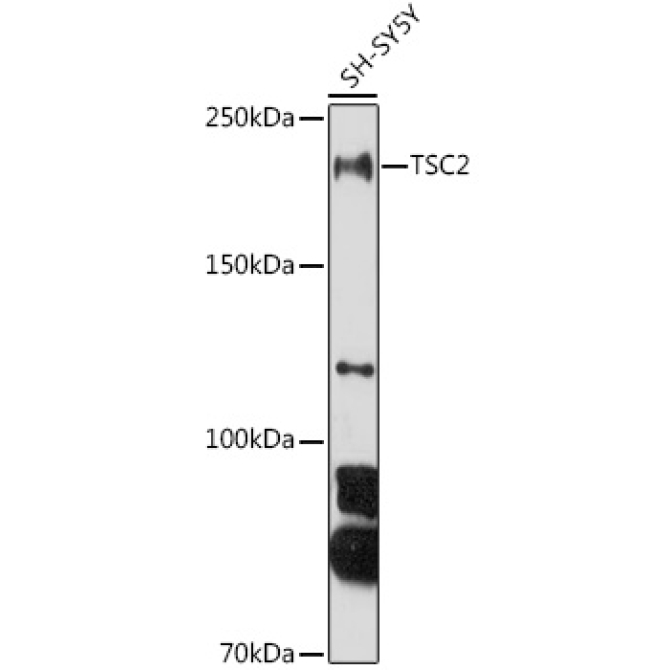 TSC2 Rabbit Polyclonal Antibody
