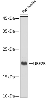 UBE2B Rabbit Monoclonal Antibody