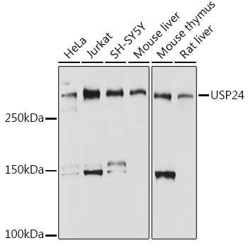 USP24 Rabbit Monoclonal Antibody