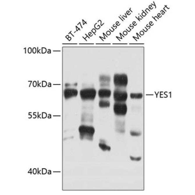 YES1 Rabbit Polyclonal Antibody