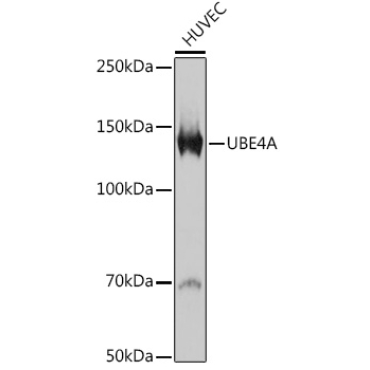 UBE4A Rabbit Monoclonal Antibody