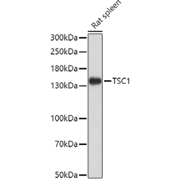 TSC1 Rabbit Polyclonal Antibody