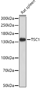TSC1 Rabbit Polyclonal Antibody