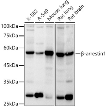 Beta-arrestin1 Rabbit Polyclonal Antibody