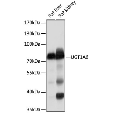 UGT1A6 Rabbit Polyclonal Antibody