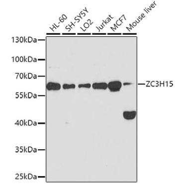 ZC3H15 Rabbit Polyclonal Antibody