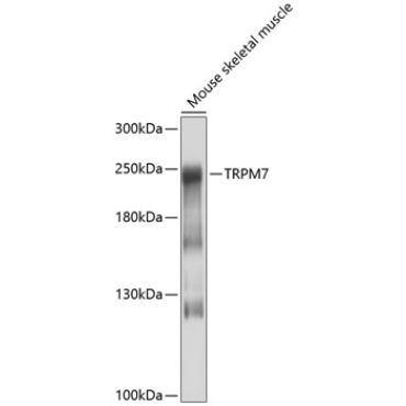 TRPM7 Rabbit Polyclonal Antibody