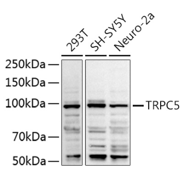 TRPC5 Rabbit Polyclonal Antibody