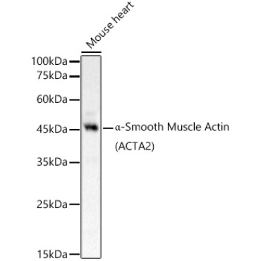 Alpha-Smooth Muscle Actin (ACTA2) Rabbit Polyclonal Antibody