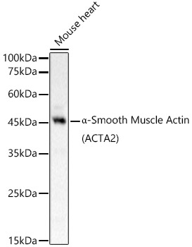 Alpha-Smooth Muscle Actin (ACTA2) Rabbit Polyclonal Antibody