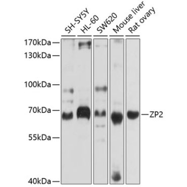 ZP2 Rabbit Polyclonal Antibody