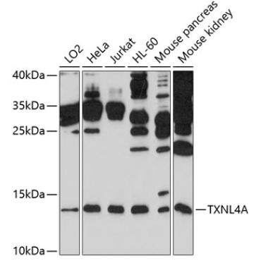 TXNL4A Rabbit Polyclonal Antibody