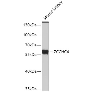 ZCCHC4 Rabbit Polyclonal Antibody
