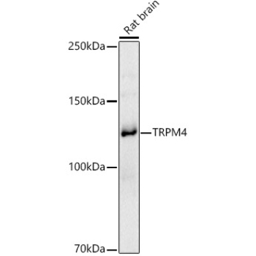 TRPM4 Rabbit Polyclonal Antibody