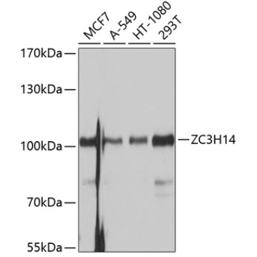 ZC3H14 Rabbit Polyclonal Antibody
