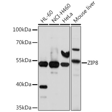 ZIP8 Rabbit Polyclonal Antibody
