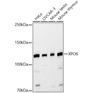 XPO6 Rabbit Polyclonal Antibody