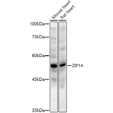 ZIP14 Rabbit Polyclonal Antibody