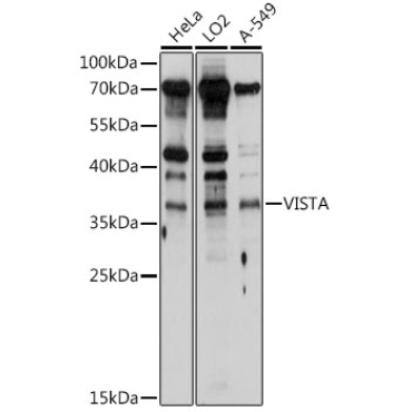 VISTA Rabbit Polyclonal Antibody
