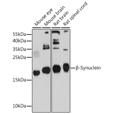 Beta-Synuclein Rabbit Polyclonal Antibody