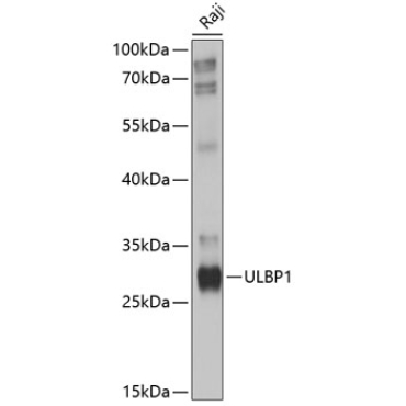 ULBP1 Rabbit Polyclonal Antibody