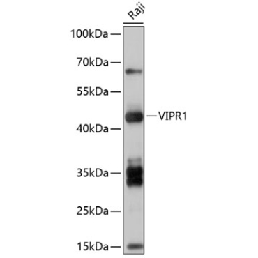 VIPR1 Rabbit Polyclonal Antibody