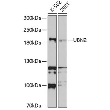 UBN2 Rabbit Polyclonal Antibody