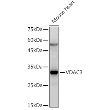 VDAC3 Rabbit Polyclonal Antibody