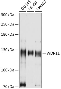 WDR11 Rabbit Polyclonal Antibody