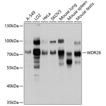 WDR26 Rabbit Polyclonal Antibody