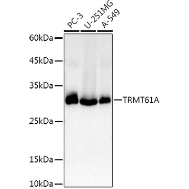 TRMT61A Rabbit Polyclonal Antibody
